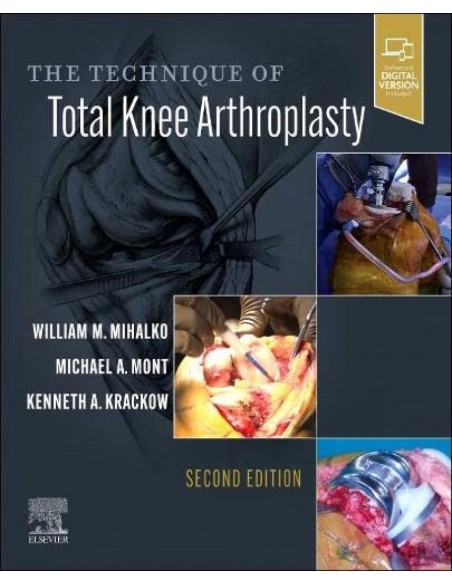 THE TECHNIQUE OF TOTAL KNEE ARTHROPLASTY 2ND EDITION