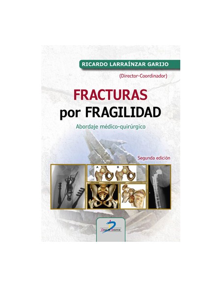 Fracturas por fragilidad abordaje medico quirurgico
