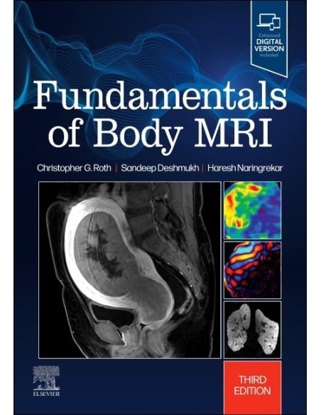 Fundamentals of body mri