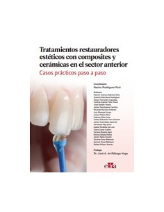 Tratamientos restauradores esteticos con composites y ceramicas en el sector anterior