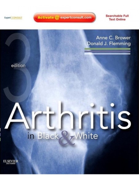 Arthritis in Black and White