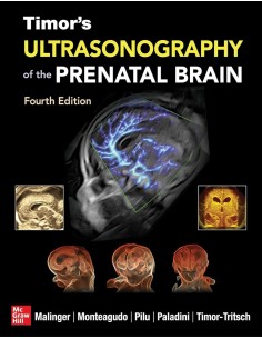 TIMOR S ULTRASONOGRAPHY OF THE PRENATAL BRAIN