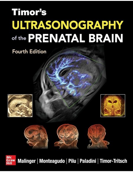 TIMOR S ULTRASONOGRAPHY OF THE PRENATAL BRAIN