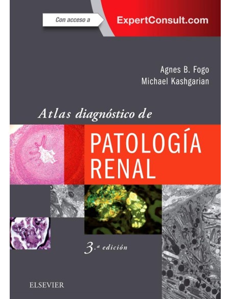 ATLAS DIAGNOSTICO DE PATOLOGIA RENAL