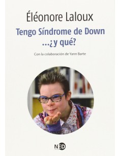 Tengo Sindrome De Down Y Que