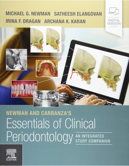 NEWMAN AND CARRANZA S ESSENTIALS OF CLINICAL PERIODONTOLOGY