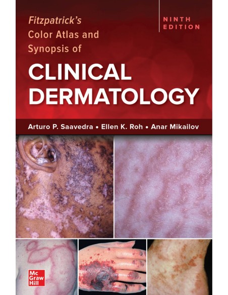 Fitzpatrick s Color Atlas and Synopsis of Clinical Dermatology Ninth Edition