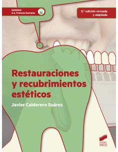 RESTAURACIONES Y RECUBRIMIENTOS ESTETICOS