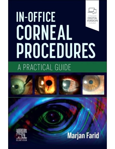 In office corneal procedures