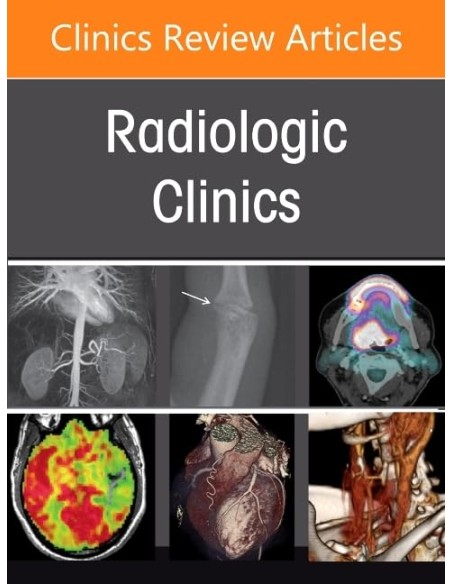 Pulmonary vascular disease radiologic clinics north