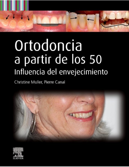 ORTODONCIA A PARTIR DE LOS 50