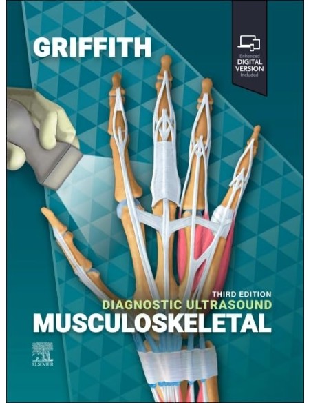 Diagnostic ultrasound Musculoskeletal