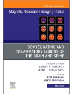 DEMYELINATING INFLAMMATORY LESIONS BRAIN SPINE VOL32 2