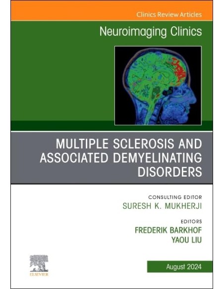 Multiple sclerosis and associated demyelinating