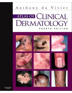 Atlas of Clinical Dermatology