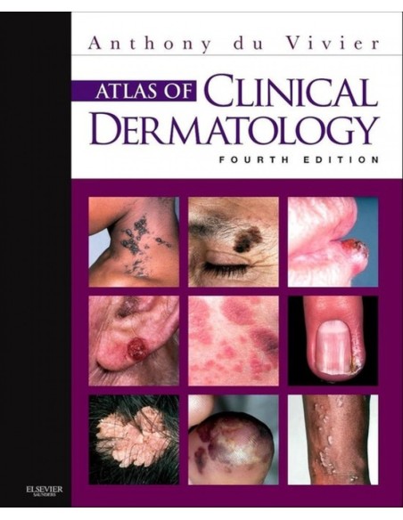 Atlas of Clinical Dermatology