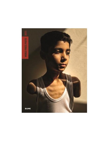 World Press Photo 2025