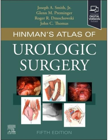 Hinmans atlas of urologic surgery
