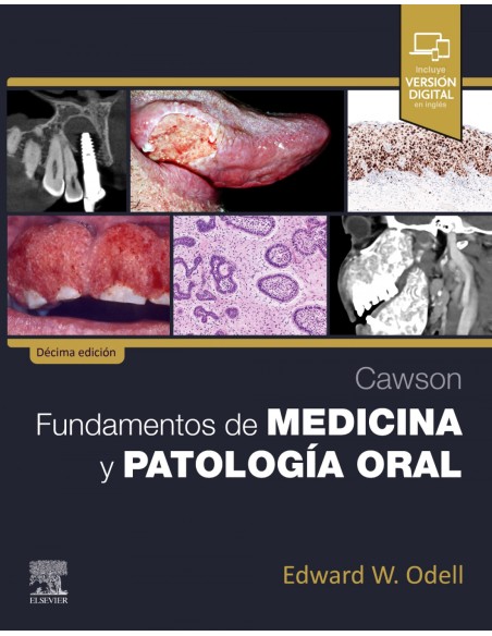 Cawsonfundamentos de medicina y patologia oral