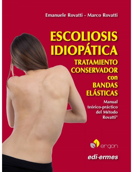 Escoliosis idiopatica Tratamiento conservador con bandas elasticas