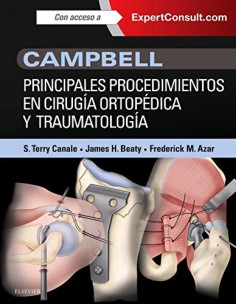 PRINCIPALES PROCEDIMIENTOS EN CIRUGIA ORTOPEDICA Y TRAUMATOLOGIA EXPERTCONSULT