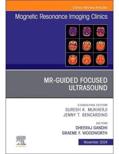 MR guided focused ultrasound