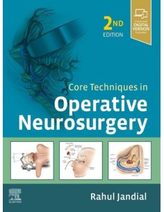 CORE TECHNIQUES IN OPERATIVE NEUROSURGERY
