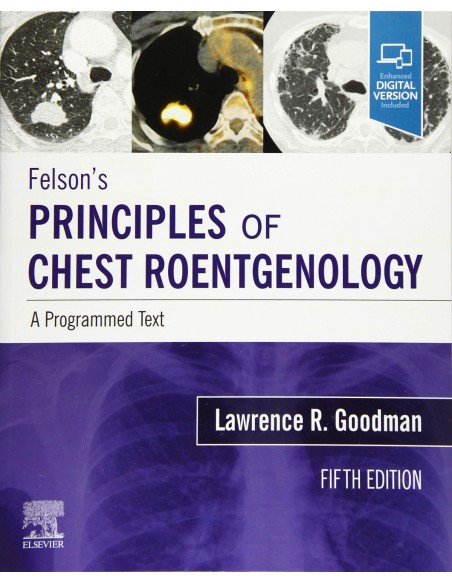 FELSONS PRINCIPLES OF CHEST ROENTGENOLOGY A PROGRAMMED