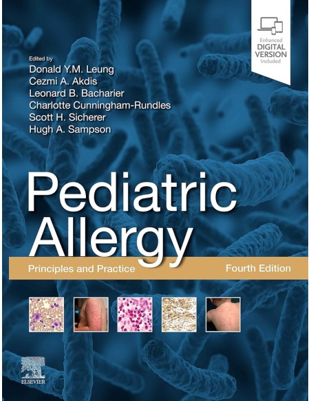 PEDIATRIC ALLERGY PRINCIPLES AND PRACTICE