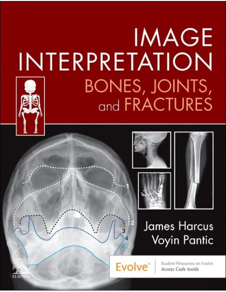 Image interpretation bones joints and fractures