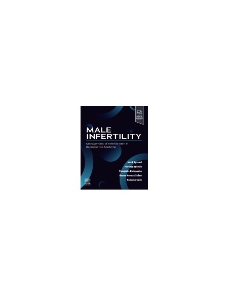 Male infertility management infertile men reproductive