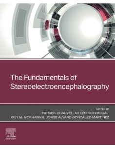 The fundamentals of stereoelectroencephalography