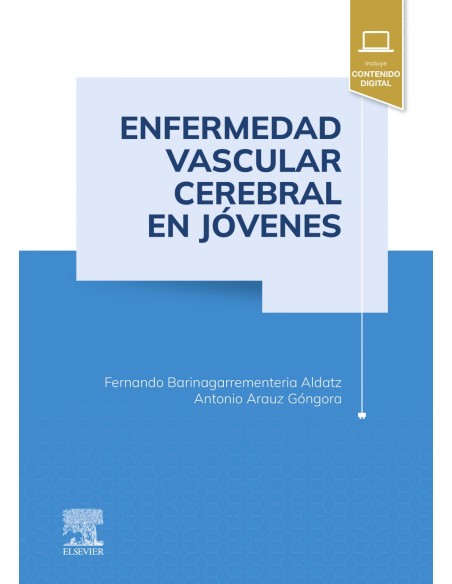 Enfermedad vascular cerebral en jovenes