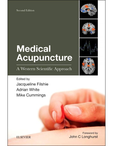 Medical Acupuncture