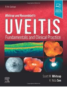 Whitcup and nussenblatts uveitis