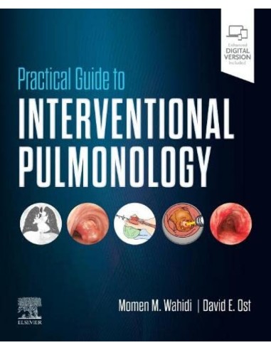 Practical guide to interventional pulmonology
