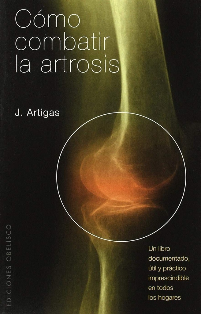Como combatir la artrosis