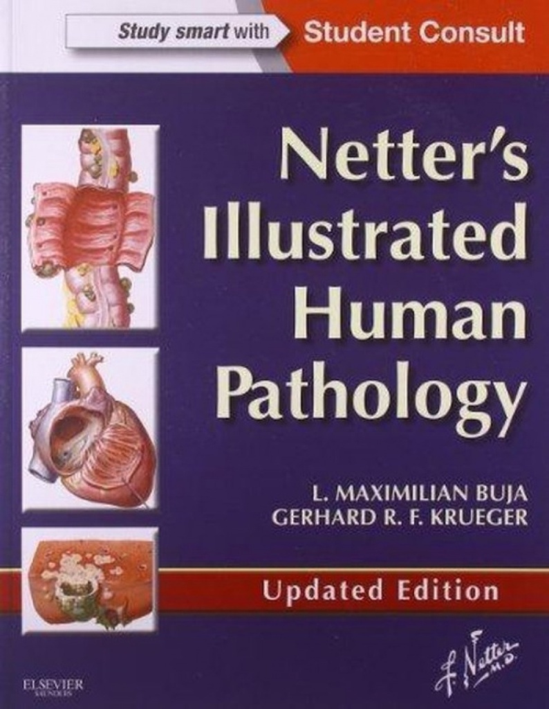 Netter's Illustrated Human Pathology Updated Edition