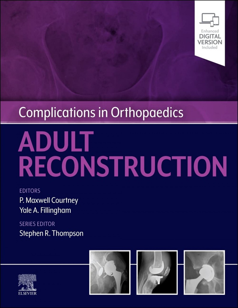 Complications in orthopaedics: adult reconstruction