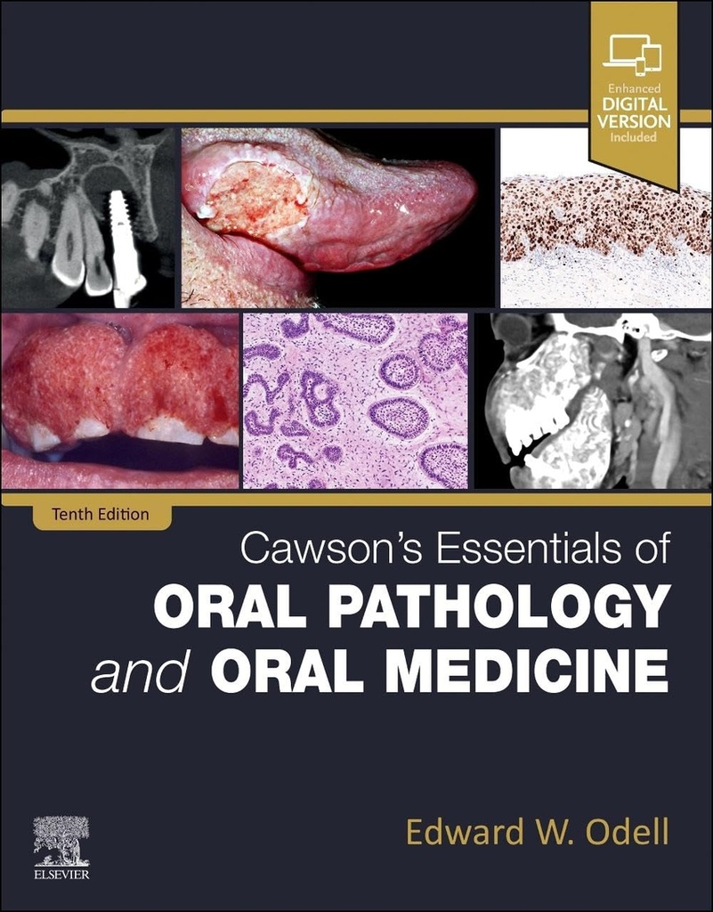 Cawson´s essentials of oral pathology and oral medicine