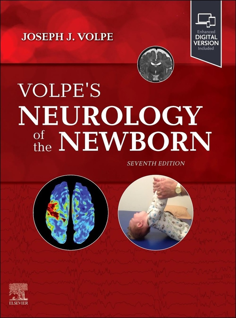 Volpe´s neurology of the newborn