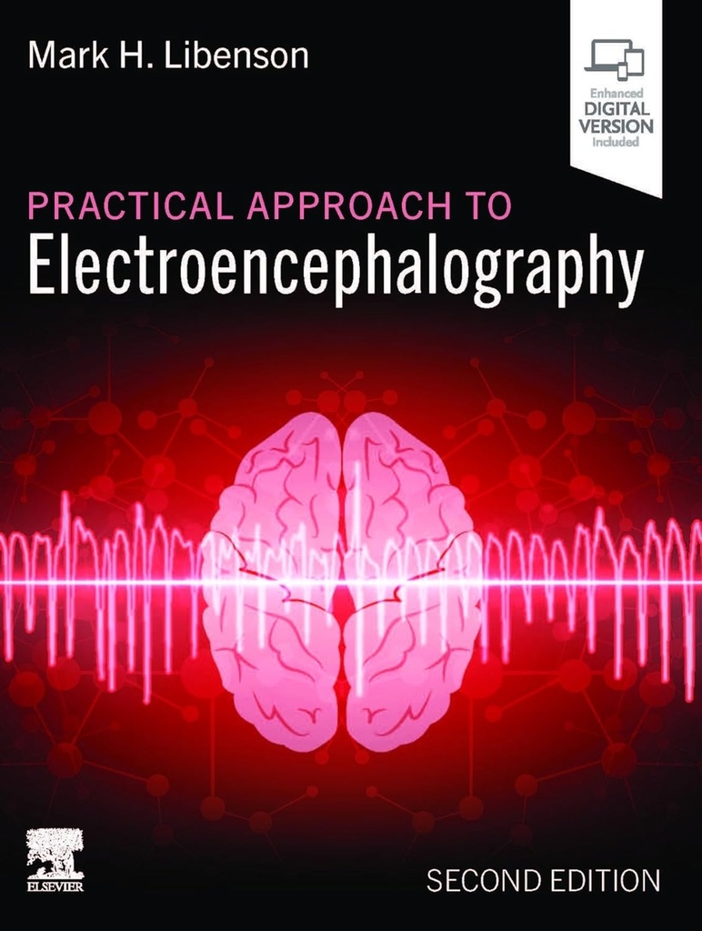 Practical approach to electroencephalographt