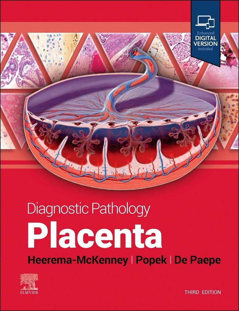 Diagnostic pathology:placenta