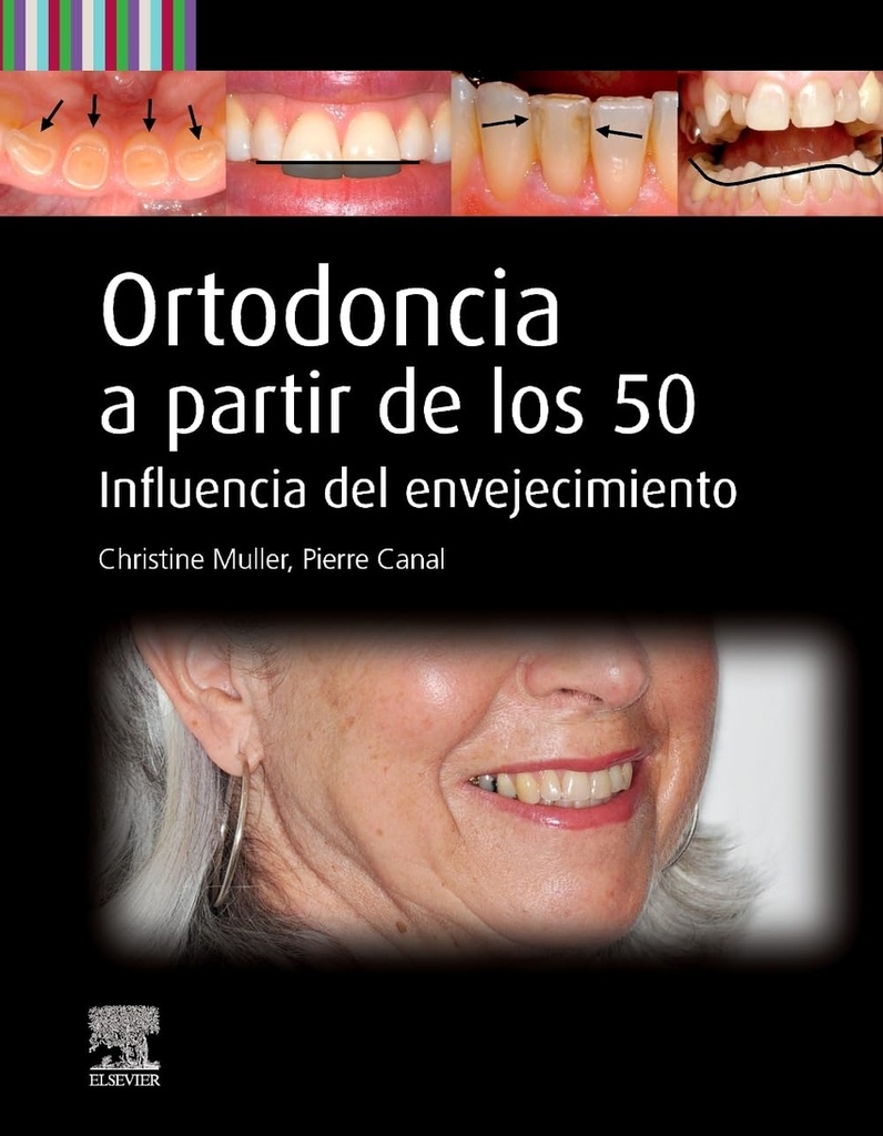ORTODONCIA A PARTIR DE LOS 50