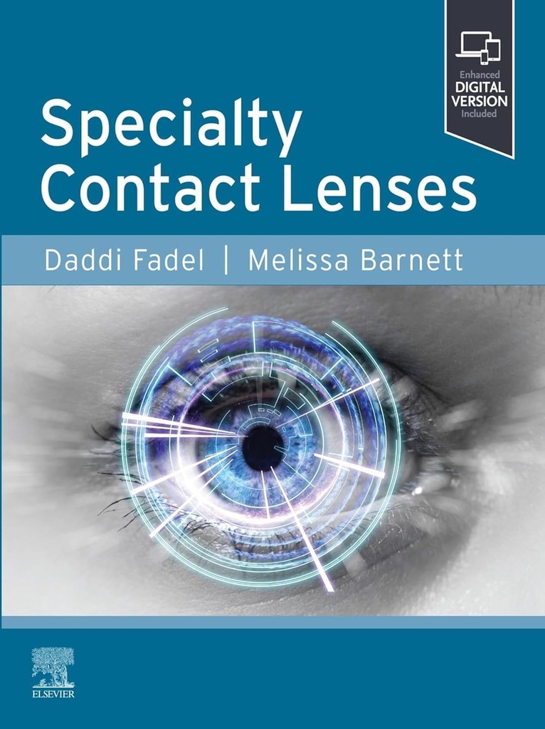 Specialty contact lenses