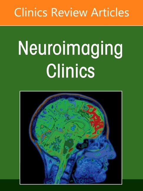 Management and treatment of cerebral aneurysms an issue