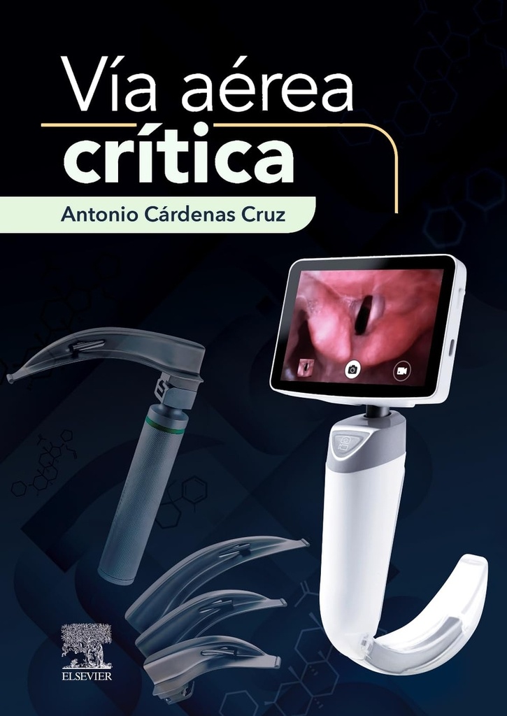 Via aerea critica