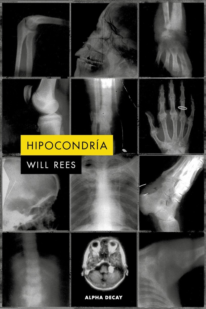 HIPOCONDRÍA