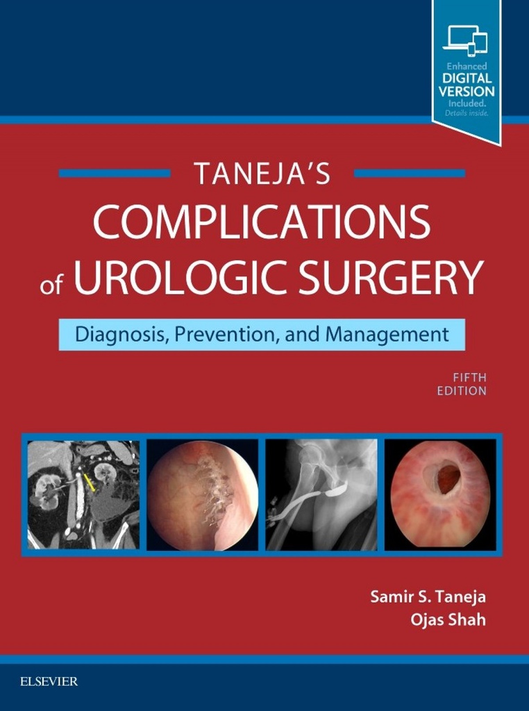COMPLICATIONS OF UROLOGIC SURGERY.(PREVENTION AND MANAGEMENT.(5TH EDITION)