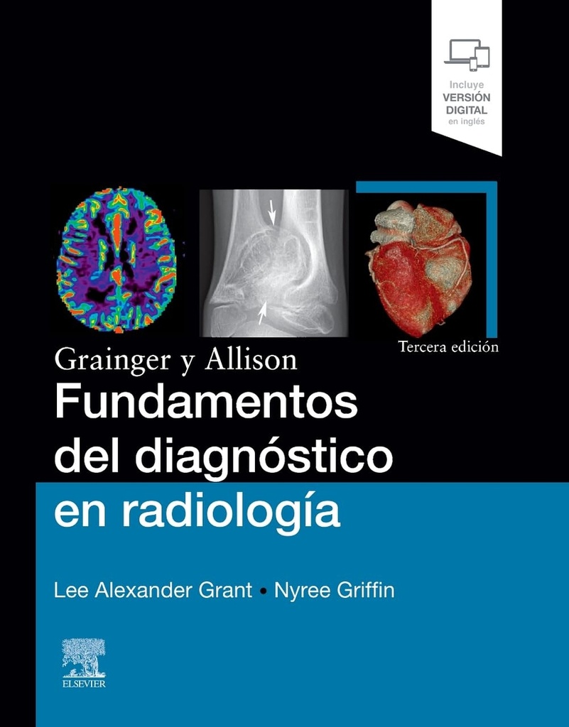 GRAINGER Y ALLISON.FUNDAMENTOS DIAGNOSTICO RADIOLOGIA